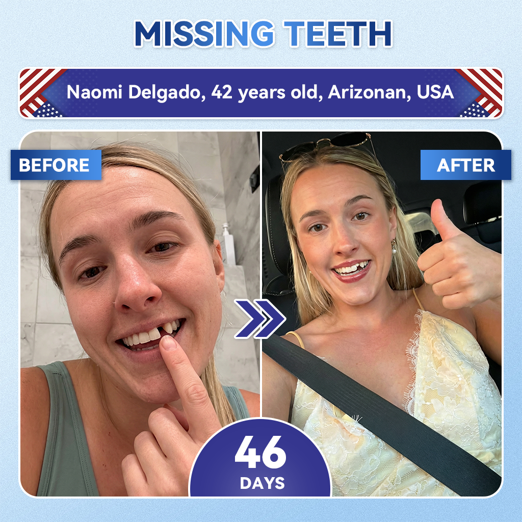 SmileFitProยฎ ๐ฆท Tideglusib FastโDissolving Tooth & Gum Repair Oral Strips โจ (๐-๐ข๐ง-๐ ๐ ๐๐๐๐ฎ๐ข๐ฅ๐ ๐๐ง๐๐ฆ๐๐ฅ & ๐๐๐ง๐ญ๐ข๐ง โข ๐๐ญ๐ซ๐๐ง๐ ๐ญ๐ก๐๐ง ๐๐ฎ๐ฆ๐ฌ โข ๐๐ซ๐๐๐ข๐๐๐ญ๐ ๐๐๐ซ๐ญ๐๐ซ & ๐๐๐จ๐ซ โข ๐๐ก๐ข๐ญ๐๐ง๐ข๐ง๐ โข ๐๐ญ๐จ๐ฉ ๐๐จ๐จ๐ญ๐ก ๐๐๐ง๐ฌ๐ข๐ญ๐ข๐ฏ๐ข๐ญ๐ฒ)