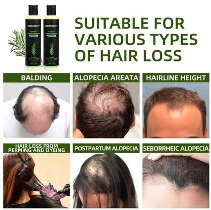 🔥LAST DAY 50% OFF - 🌿OLIOKINDRED® Organic Rosemary Hair Growth Shampoo