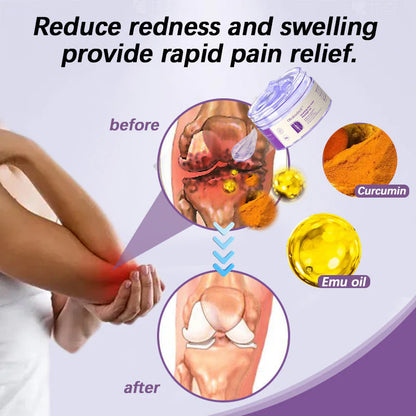 ✅ Official store: Oliokindred™ Turmeric & Emu Oil Arthritis Soothing Pain Relief Massage Gel(👨‍⚕️AAD Recommended)