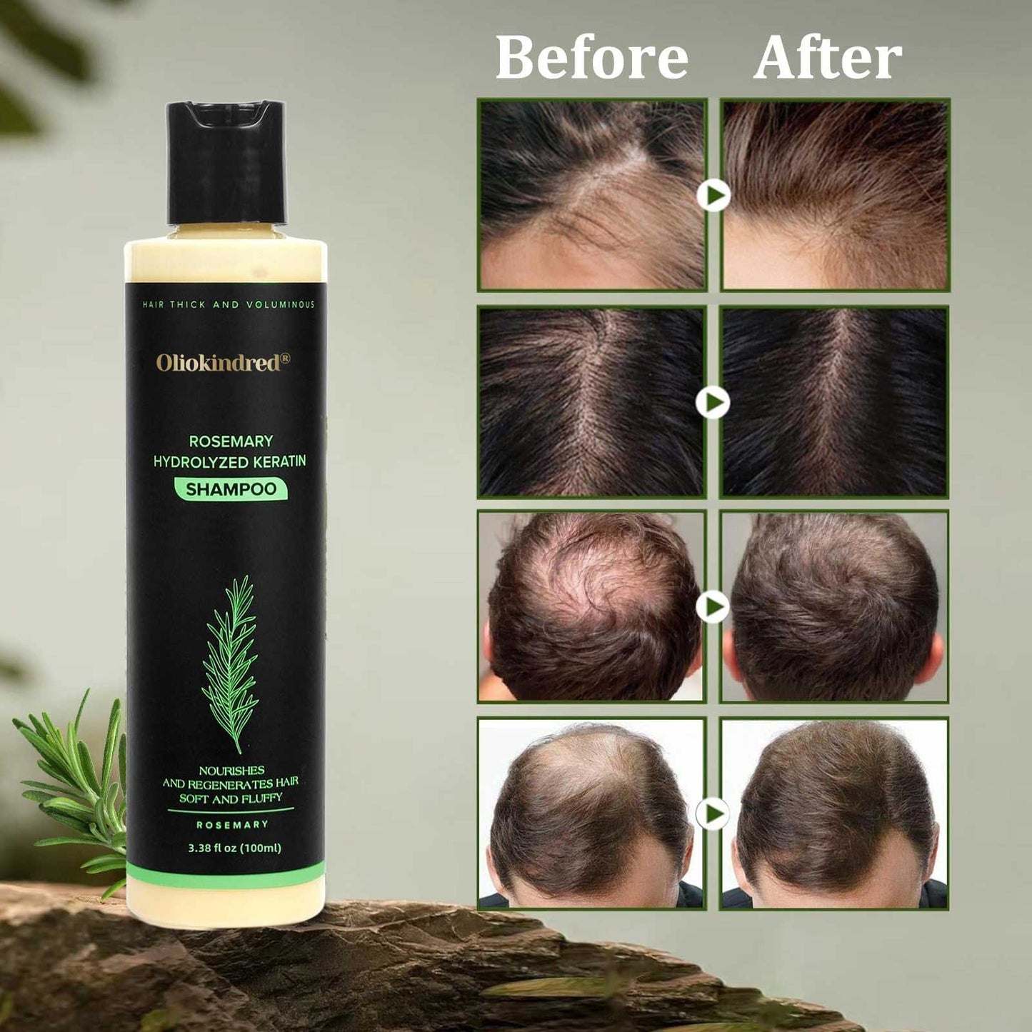 🔥LAST DAY 50% OFF - 🌿OLIOKINDRED® Organic Rosemary Hair Growth Shampoo