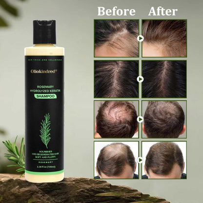 🔥LAST DAY 50% OFF - 🌿OLIOKINDRED® Organic Rosemary Hair Growth Shampoo