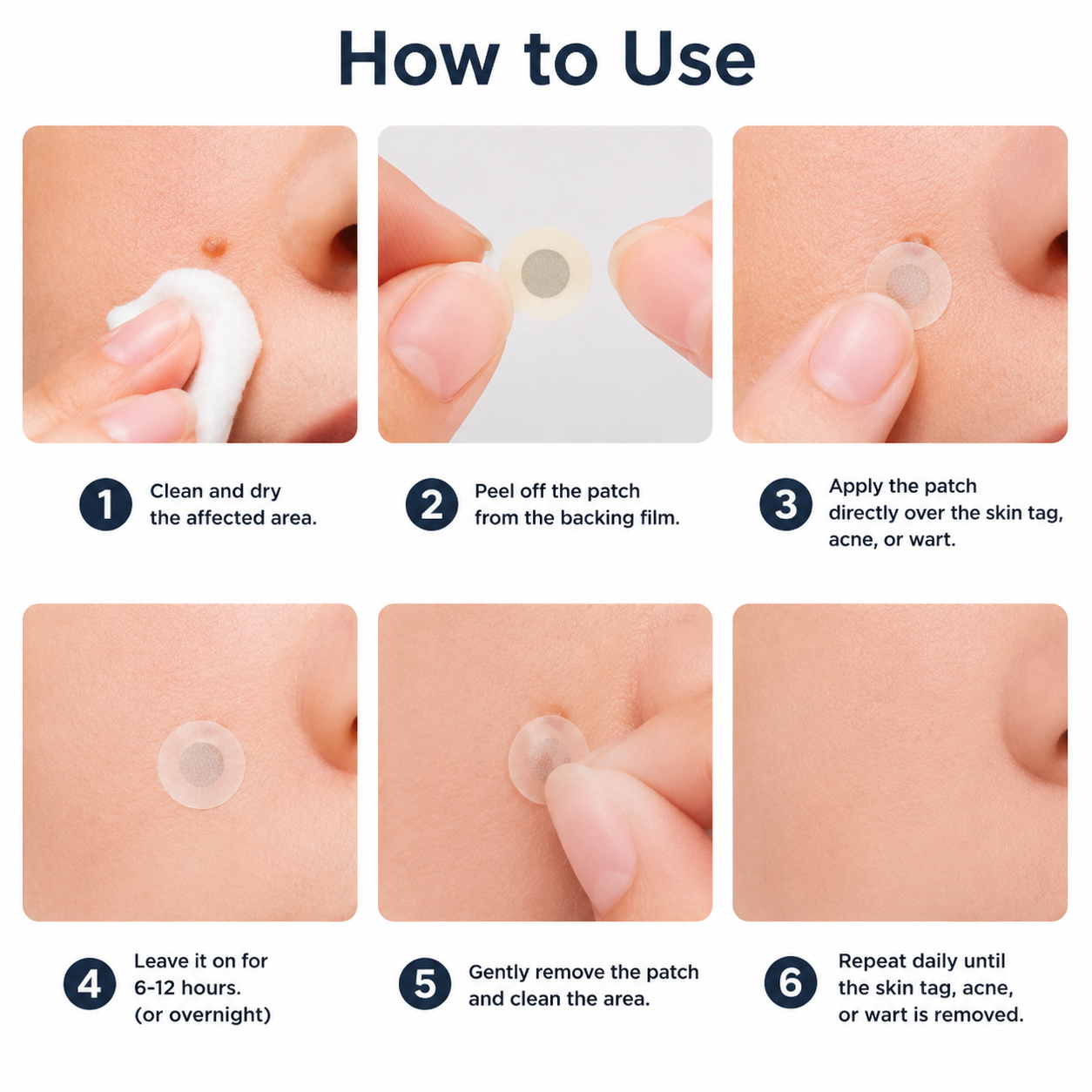 ✨OLIOKINDRED®2-in-1 Microneedle & Hydrocolloid Patch🍀| Removes Raised Moles, Acne, Flat Warts & Skin Tags | Helps Improve Wrinkles, Scars & Blemishes | Invisible Patches for Face & Body