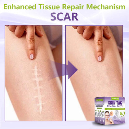 Oliokindred® Soluble Microneedle Botanical Skin Tag Removal Patch