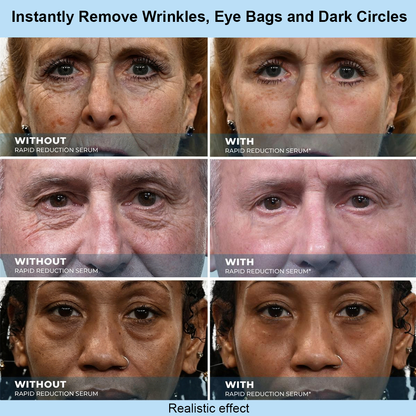 OLIOKINDRED™ Instant Face Temporary Tightener – Instant visible results in 30 seconds