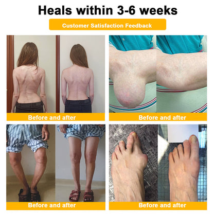 🎁 Special Flash Offer | Bee Venom Ultimate Muscle & Joint Repair Cream 🐝
