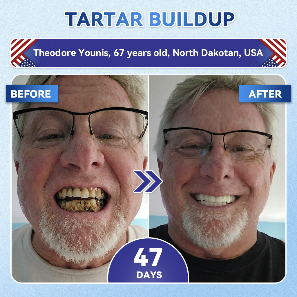 SmileFitPro® 🦷 Tideglusib Fast‑Dissolving Tooth & Gum Repair Oral Strips ✨ (𝟓-𝐢𝐧-𝟏 💎 𝐑𝐞𝐛𝐮𝐢𝐥𝐝 𝐄𝐧𝐚𝐦𝐞𝐥 & 𝐃𝐞𝐧𝐭𝐢𝐧 • 𝐒𝐭𝐫𝐞𝐧𝐠𝐭𝐡𝐞𝐧 𝐆𝐮𝐦𝐬 • 𝐄𝐫𝐚𝐝𝐢𝐜𝐚𝐭𝐞 𝐓𝐚𝐫𝐭𝐚𝐫 & 𝐎𝐝𝐨𝐫 • 𝐖𝐡𝐢𝐭𝐞𝐧𝐢𝐧𝐠 • 𝐒𝐭𝐨𝐩 𝐓𝐨𝐨𝐭𝐡 𝐒𝐞𝐧𝐬𝐢𝐭𝐢𝐯𝐢𝐭𝐲)