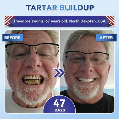 SmileFitPro® 🦷 Tideglusib Fast‑Dissolving Tooth & Gum Repair Oral Strips ✨ (𝟓-𝐢𝐧-𝟏 💎 𝐑𝐞𝐛𝐮𝐢𝐥𝐝 𝐄𝐧𝐚𝐦𝐞𝐥 & 𝐃𝐞𝐧𝐭𝐢𝐧 • 𝐒𝐭𝐫𝐞𝐧𝐠𝐭𝐡𝐞𝐧 𝐆𝐮𝐦𝐬 • 𝐄𝐫𝐚𝐝𝐢𝐜𝐚𝐭𝐞 𝐓𝐚𝐫𝐭𝐚𝐫 & 𝐎𝐝𝐨𝐫 • 𝐖𝐡𝐢𝐭𝐞𝐧𝐢𝐧𝐠 • 𝐒𝐭𝐨𝐩 𝐓𝐨𝐨𝐭𝐡 𝐒𝐞𝐧𝐬𝐢𝐭𝐢𝐯𝐢𝐭𝐲)