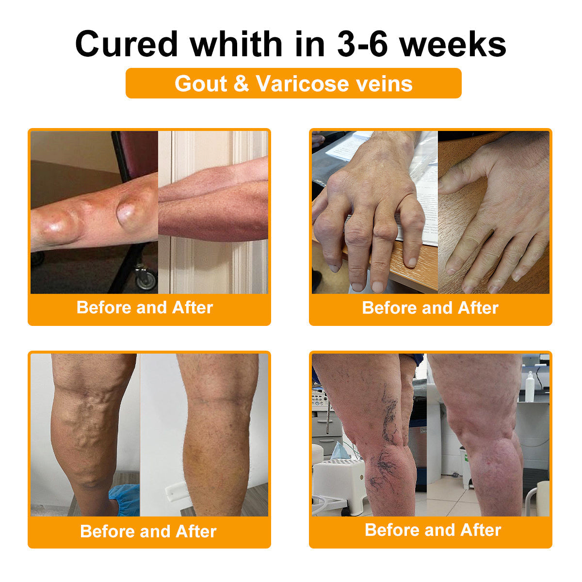 🎁 Special Flash Offer | Bee Venom Ultimate Muscle & Joint Repair Cream 🐝