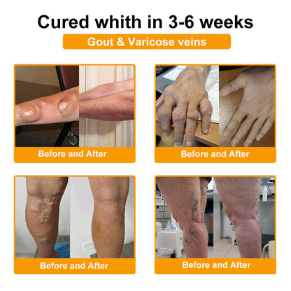 🎁 Special Flash Offer | Bee Venom Ultimate Muscle & Joint Repair Cream 🐝