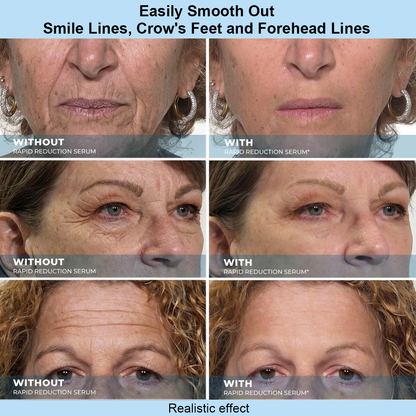 OLIOKINDRED™ Instant Face Temporary Tightener – Instant visible results in 30 seconds