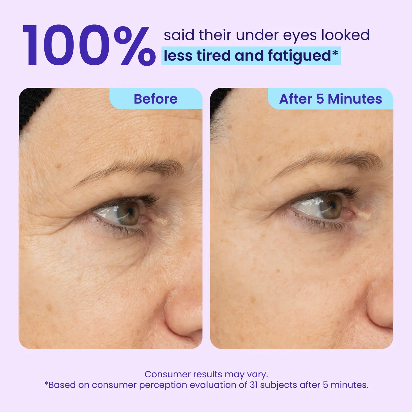 Instant Lift Eye Gel — Reduce the Look of Eye Bags in Minutes 🔥