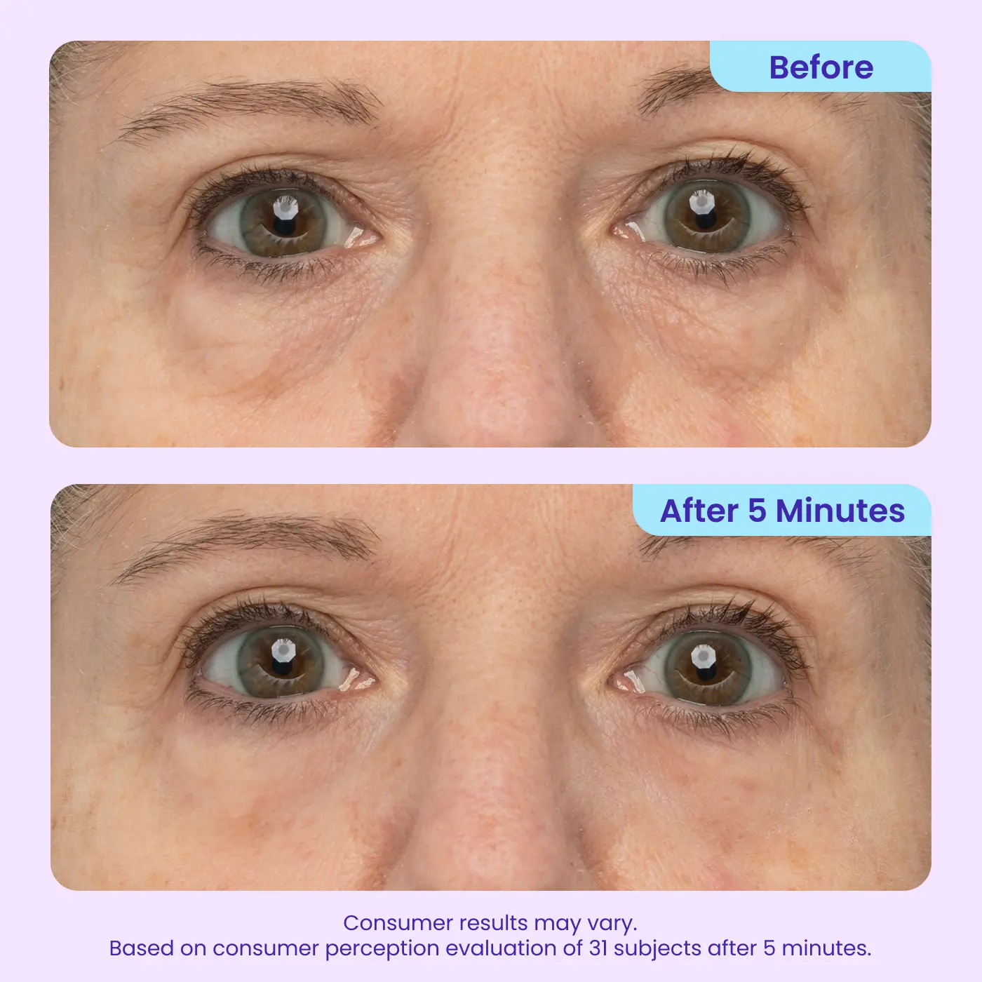 Instant Lift Eye Gel — Reduce the Look of Eye Bags in Minutes 🔥