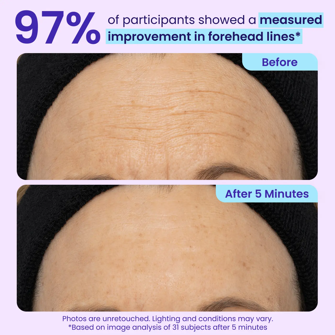Instant Lift Eye Gel — Reduce the Look of Eye Bags in Minutes 🔥