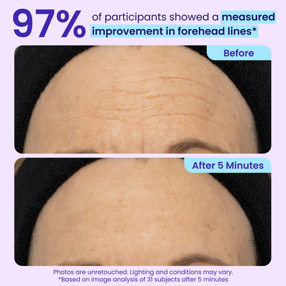 Instant Lift Eye Gel — Reduce the Look of Eye Bags in Minutes 🔥