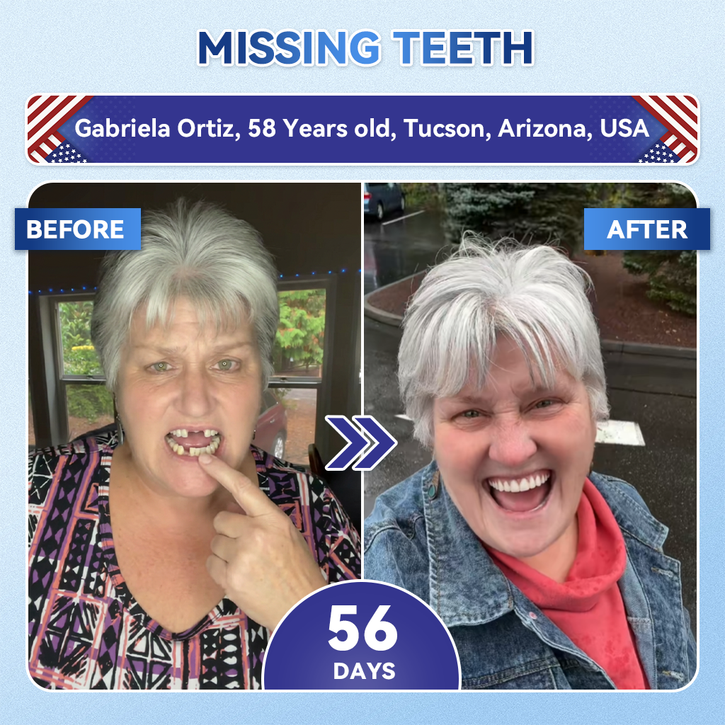 SmileFitPro® 🦷 Tideglusib Fast‑Dissolving Tooth & Gum Repair Oral Strips ✨ (𝟓-𝐢𝐧-𝟏 💎 𝐑𝐞𝐛𝐮𝐢𝐥𝐝 𝐄𝐧𝐚𝐦𝐞𝐥 & 𝐃𝐞𝐧𝐭𝐢𝐧 • 𝐒𝐭𝐫𝐞𝐧𝐠𝐭𝐡𝐞𝐧 𝐆𝐮𝐦𝐬 • 𝐄𝐫𝐚𝐝𝐢𝐜𝐚𝐭𝐞 𝐓𝐚𝐫𝐭𝐚𝐫 & 𝐎𝐝𝐨𝐫 • 𝐖𝐡𝐢𝐭𝐞𝐧𝐢𝐧𝐠 • 𝐒𝐭𝐨𝐩 𝐓𝐨𝐨𝐭𝐡 𝐒𝐞𝐧𝐬𝐢𝐭𝐢𝐯𝐢𝐭𝐲)