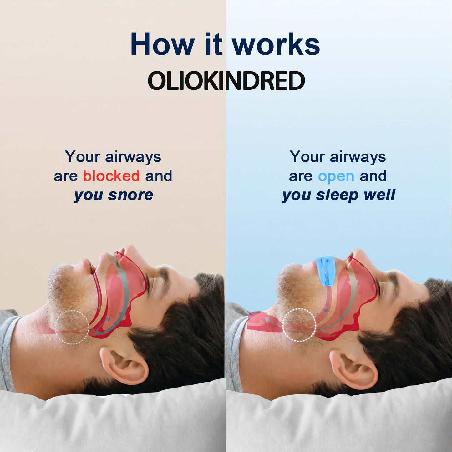 Oliokindred™  Professional intelligent anti-snoring device