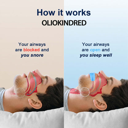 Oliokindred™  Professional intelligent anti-snoring device