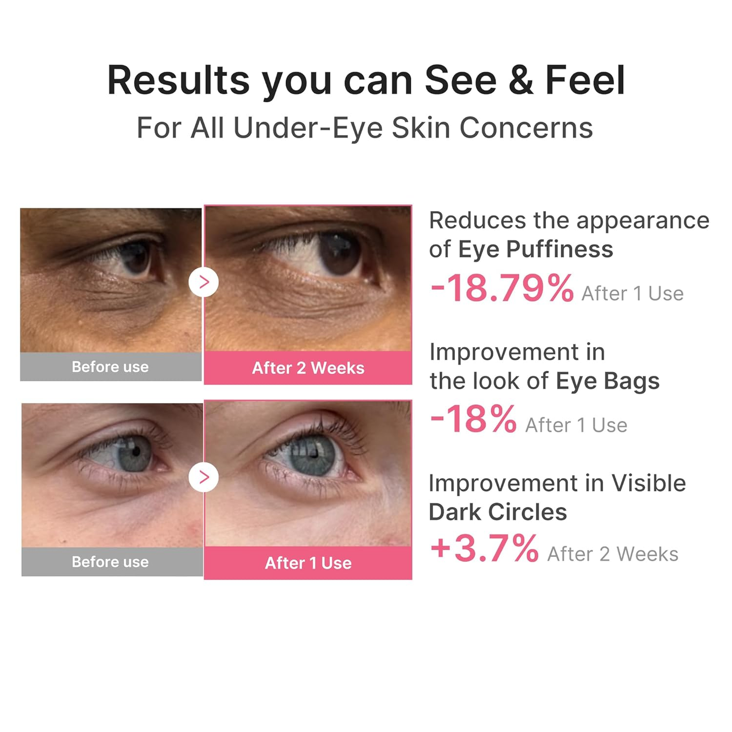 Hopearve Pink Caffeine Collagen Eye Patch – 10-Minute Eye Revival Treatment