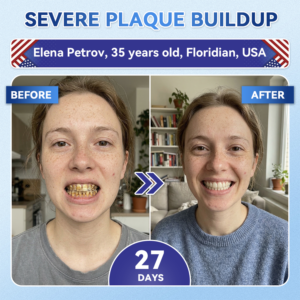 SmileFitPro® 🦷 Tideglusib Fast‑Dissolving Tooth & Gum Repair Oral Strips ✨ (𝟓-𝐢𝐧-𝟏 💎 𝐑𝐞𝐛𝐮𝐢𝐥𝐝 𝐄𝐧𝐚𝐦𝐞𝐥 & 𝐃𝐞𝐧𝐭𝐢𝐧 • 𝐒𝐭𝐫𝐞𝐧𝐠𝐭𝐡𝐞𝐧 𝐆𝐮𝐦𝐬 • 𝐄𝐫𝐚𝐝𝐢𝐜𝐚𝐭𝐞 𝐓𝐚𝐫𝐭𝐚𝐫 & 𝐎𝐝𝐨𝐫 • 𝐖𝐡𝐢𝐭𝐞𝐧𝐢𝐧𝐠 • 𝐒𝐭𝐨𝐩 𝐓𝐨𝐨𝐭𝐡 𝐒𝐞𝐧𝐬𝐢𝐭𝐢𝐯𝐢𝐭𝐲)