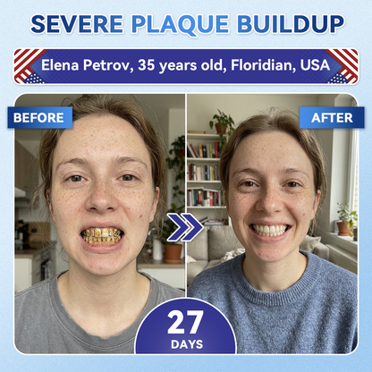 SmileFitPro® 🦷 Tideglusib Fast‑Dissolving Tooth & Gum Repair Oral Strips ✨ (𝟓-𝐢𝐧-𝟏 💎 𝐑𝐞𝐛𝐮𝐢𝐥𝐝 𝐄𝐧𝐚𝐦𝐞𝐥 & 𝐃𝐞𝐧𝐭𝐢𝐧 • 𝐒𝐭𝐫𝐞𝐧𝐠𝐭𝐡𝐞𝐧 𝐆𝐮𝐦𝐬 • 𝐄𝐫𝐚𝐝𝐢𝐜𝐚𝐭𝐞 𝐓𝐚𝐫𝐭𝐚𝐫 & 𝐎𝐝𝐨𝐫 • 𝐖𝐡𝐢𝐭𝐞𝐧𝐢𝐧𝐠 • 𝐒𝐭𝐨𝐩 𝐓𝐨𝐨𝐭𝐡 𝐒𝐞𝐧𝐬𝐢𝐭𝐢𝐯𝐢𝐭𝐲)