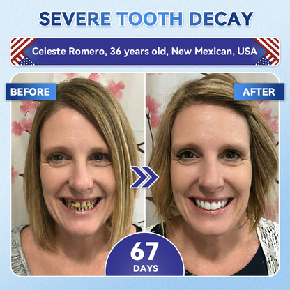 SmileFitPro® 🦷 Tideglusib Fast‑Dissolving Tooth & Gum Repair Oral Strips ✨ (𝟓-𝐢𝐧-𝟏 💎 𝐑𝐞𝐛𝐮𝐢𝐥𝐝 𝐄𝐧𝐚𝐦𝐞𝐥 & 𝐃𝐞𝐧𝐭𝐢𝐧 • 𝐒𝐭𝐫𝐞𝐧𝐠𝐭𝐡𝐞𝐧 𝐆𝐮𝐦𝐬 • 𝐄𝐫𝐚𝐝𝐢𝐜𝐚𝐭𝐞 𝐓𝐚𝐫𝐭𝐚𝐫 & 𝐎𝐝𝐨𝐫 • 𝐖𝐡𝐢𝐭𝐞𝐧𝐢𝐧𝐠 • 𝐒𝐭𝐨𝐩 𝐓𝐨𝐨𝐭𝐡 𝐒𝐞𝐧𝐬𝐢𝐭𝐢𝐯𝐢𝐭𝐲)