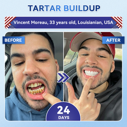 SmileFitPro® 🦷 Tideglusib Fast‑Dissolving Tooth & Gum Repair Oral Strips ✨ (𝟓-𝐢𝐧-𝟏 💎 𝐑𝐞𝐛𝐮𝐢𝐥𝐝 𝐄𝐧𝐚𝐦𝐞𝐥 & 𝐃𝐞𝐧𝐭𝐢𝐧 • 𝐒𝐭𝐫𝐞𝐧𝐠𝐭𝐡𝐞𝐧 𝐆𝐮𝐦𝐬 • 𝐄𝐫𝐚𝐝𝐢𝐜𝐚𝐭𝐞 𝐓𝐚𝐫𝐭𝐚𝐫 & 𝐎𝐝𝐨𝐫 • 𝐖𝐡𝐢𝐭𝐞𝐧𝐢𝐧𝐠 • 𝐒𝐭𝐨𝐩 𝐓𝐨𝐨𝐭𝐡 𝐒𝐞𝐧𝐬𝐢𝐭𝐢𝐯𝐢𝐭𝐲)