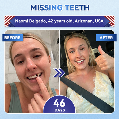 SmileFitPro® 🦷 Tideglusib Fast‑Dissolving Tooth & Gum Repair Oral Strips ✨ (𝟓-𝐢𝐧-𝟏 💎 𝐑𝐞𝐛𝐮𝐢𝐥𝐝 𝐄𝐧𝐚𝐦𝐞𝐥 & 𝐃𝐞𝐧𝐭𝐢𝐧 • 𝐒𝐭𝐫𝐞𝐧𝐠𝐭𝐡𝐞𝐧 𝐆𝐮𝐦𝐬 • 𝐄𝐫𝐚𝐝𝐢𝐜𝐚𝐭𝐞 𝐓𝐚𝐫𝐭𝐚𝐫 & 𝐎𝐝𝐨𝐫 • 𝐖𝐡𝐢𝐭𝐞𝐧𝐢𝐧𝐠 • 𝐒𝐭𝐨𝐩 𝐓𝐨𝐨𝐭𝐡 𝐒𝐞𝐧𝐬𝐢𝐭𝐢𝐯𝐢𝐭𝐲)