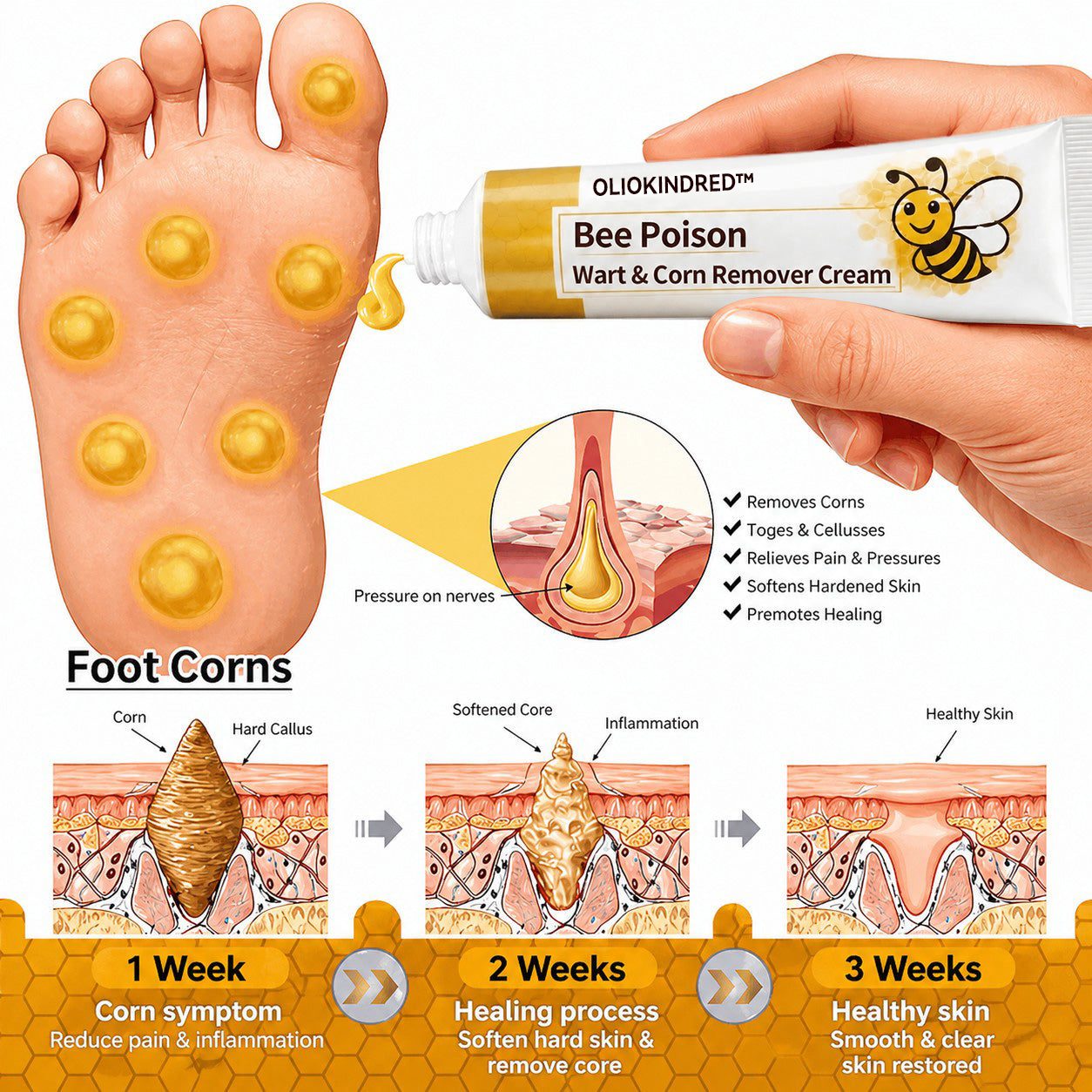 👨‍⚕️OLIOKINDRED™Bee Poison Wart & Corn Remover Cream⚡
