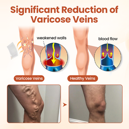 VeinTarget Microneedle Patch