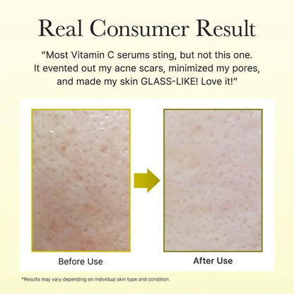Hemspire Vitamin C Booster Shot Serum with Glutathione,Niacinamide and Vitamin E