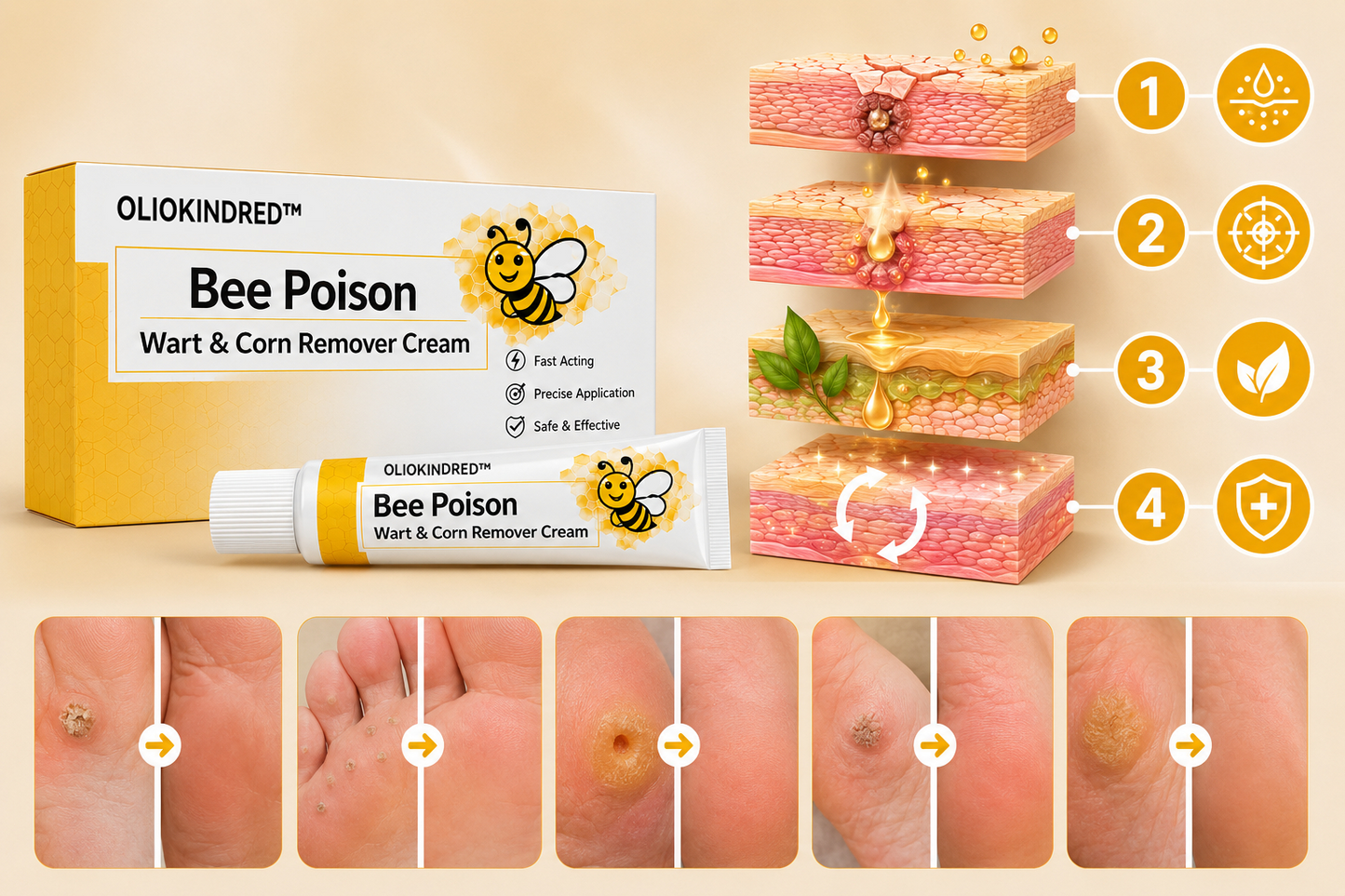 👨‍⚕️OLIOKINDRED™Bee Poison Wart & Corn Remover Cream⚡
