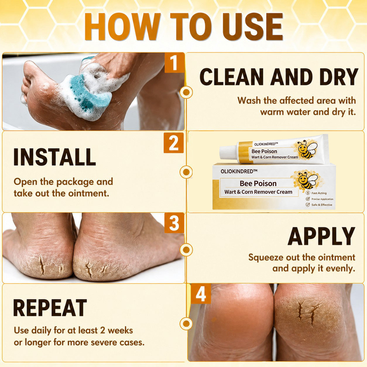👨‍⚕️OLIOKINDRED™Bee Poison Wart & Corn Remover Cream⚡