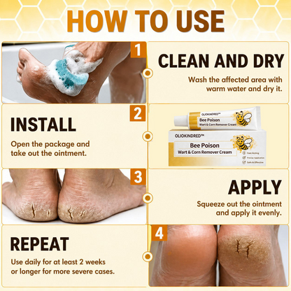 👨‍⚕️OLIOKINDRED™Bee Poison Wart & Corn Remover Cream⚡
