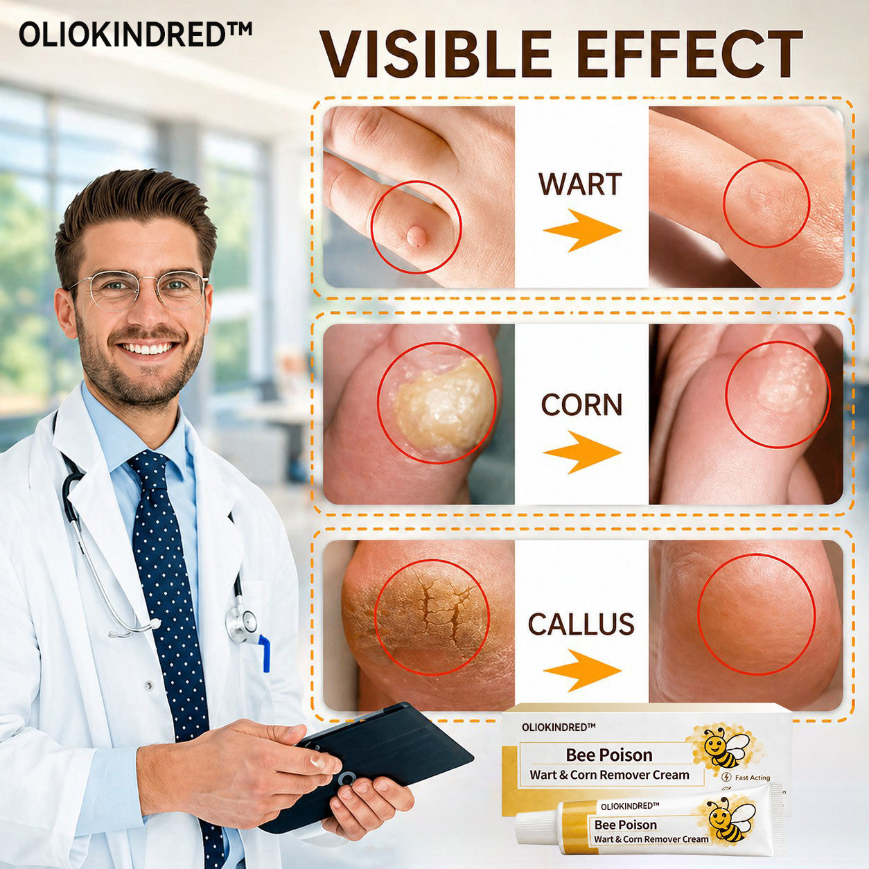 👨‍⚕️OLIOKINDRED™Bee Poison Wart & Corn Remover Cream⚡
