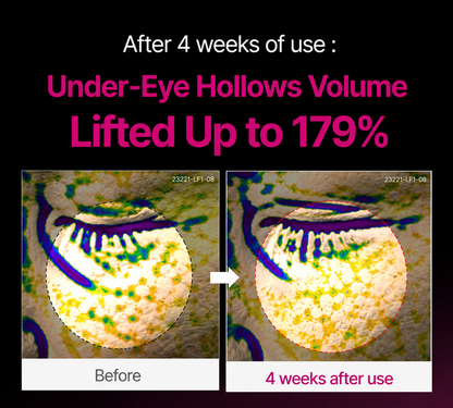 🔥LAST DAY 50% OFF!! OLIOKINDRED Korean Calcium Dark Spot Eye Cream