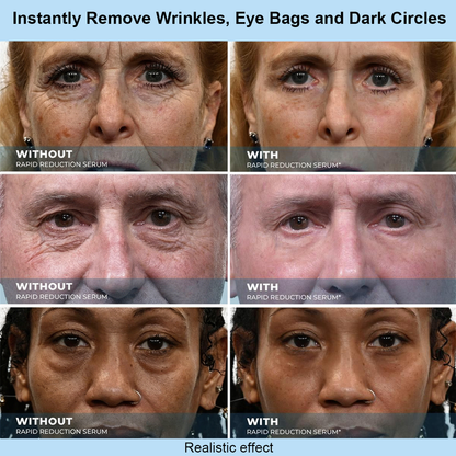 OLIOKINDRED™ Instant Face Temporary Tightener – Instant visible results in 30 seconds